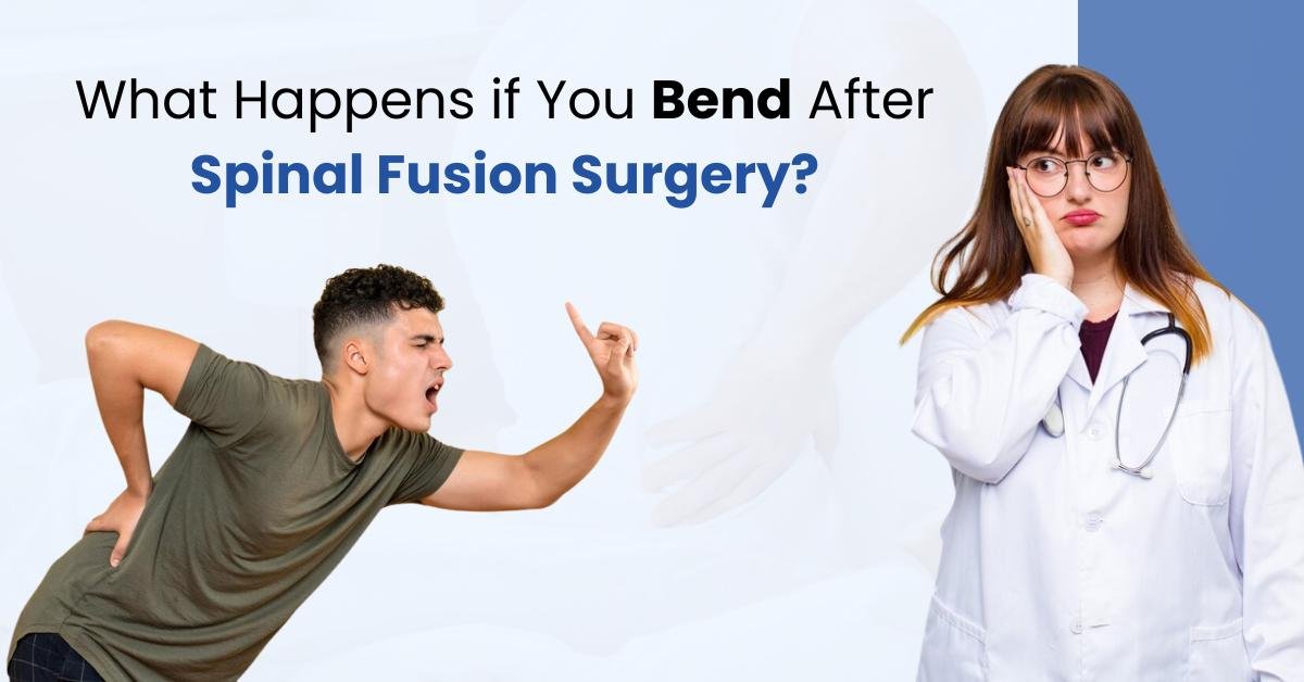 What Happens if You Bend After Spinal Fusion Surgery